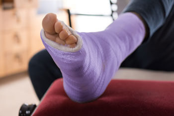 Foot and ankle fractures treatment in the Tarrant County: Arlington, Fort Worth, Haltom City, Euless, Bedford, Dallas County: Dallas, Irving, Grand Prairie, Farmers Branch, Denton County: Flower Mound, Denton, Collin County: Plano, Garland areas