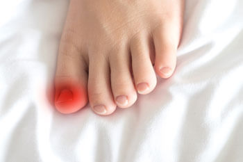 Ingrown toenail treatment in the Tarrant County: Arlington, Fort Worth, Haltom City, Euless, Bedford, Dallas County: Dallas, Irving, Grand Prairie, Farmers Branch, Denton County: Flower Mound, Denton, Collin County: Plano, Garland areas