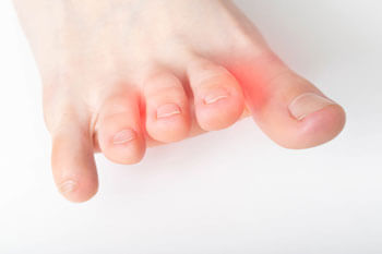 Morton's neuromas treatment in the Tarrant County: Arlington, Fort Worth, Haltom City, Euless, Bedford, Dallas County: Dallas, Irving, Grand Prairie, Farmers Branch, Denton County: Flower Mound, Denton, Collin County: Plano, Garland areas
