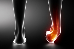 Causes and Diagnosis of Ankle Sprains