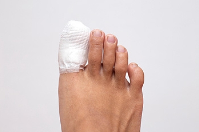 Broken Versus Jammed Toe