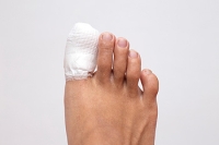 Broken Versus Jammed Toe