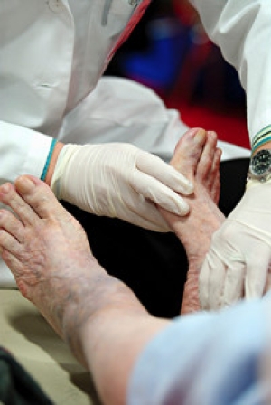 Facts About Falls and Fall Prevention