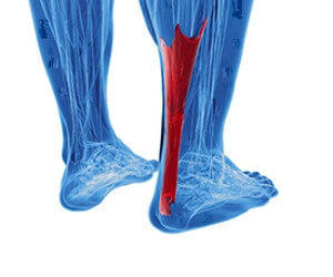 Study Finds that Achilles and Bone Injuries More Likely to Occur in Track and Field Events