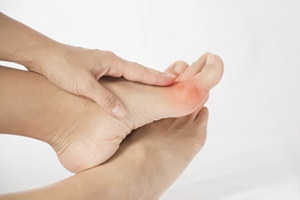 Managing Bunions